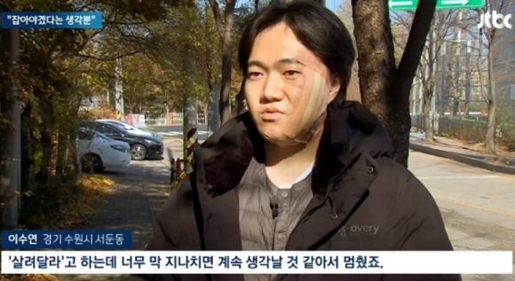 아버지와 아들이 '묻지마 폭행'을 당하는 여성을 구한 사연이 알려졌다. 피해자를 구하는 과정에서 아들 이수연 씨는 얼굴을 크게 다치고도 "피해자가 무사해서 다행"이라고 말했다. [사진=JTBC 보도화면 캡처]