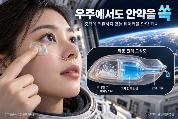 웨어러블 안약 패치…스스로 안약 넣기 힘든 사람도 OK [지금은 과학]