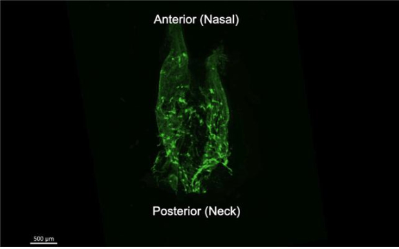 형광 표지자 발현 생쥐의 비인두 림프관망을 조직투명화 과정 후 3차원으로 재구성한 영상 [사진=IBS ]