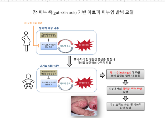 아토피 피부염은 가려움증과 피부 건조증을 동반하는 질환이다. [사진=아이뉴스24DB]
