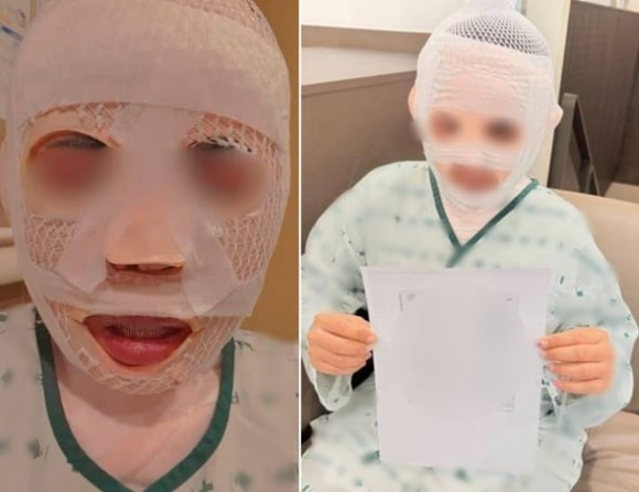 한국 남자친구의 폭행 피해를 입었다는 태국인 여성 [사진=페이스북]