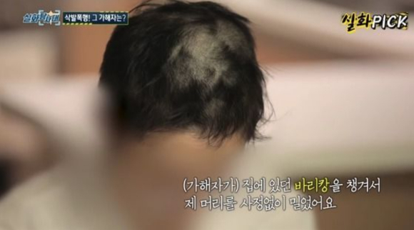 여자친구를 감금하고 바리캉으로 머리를 미는 등 수 차례 폭행·성폭행한 남성이 1심 판결 전 법원에 억대 공탁금을 걸었다. 위 사진은 피해자가 2023년 8월 10일 방송된 MBC '실화탐사대'를 통해 피해 사실을 알리는 모습. [사진=MBC '실화탐사대' 방송화면 캡처]