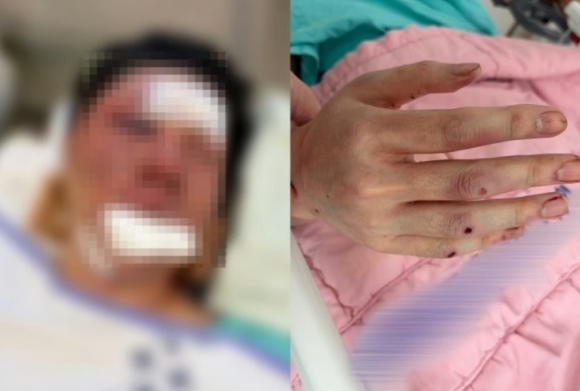 폭행 당한 수탉. [사진=수탉 SOOP(옛 아프리카TV) 채]