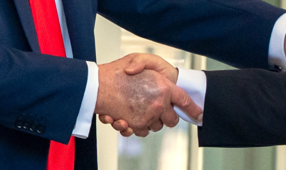 지난 25일(현지시간) 백악관에서 이재명 대통령과 악수하는 도널드 트럼프 미국 대통령(왼쪽)의 오른손 손등에 멍으로 보이는 검푸른 자국이 포착됐다. [사진=AP/연합뉴스]