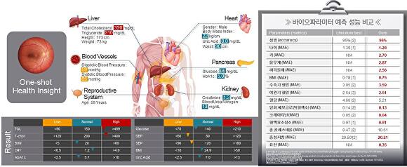 "눈만 봐도 알 수 있다"...경기도 지원 연구진, '안저영상 AI 분석 기술' ... - 뉴스 썸네일 이미지