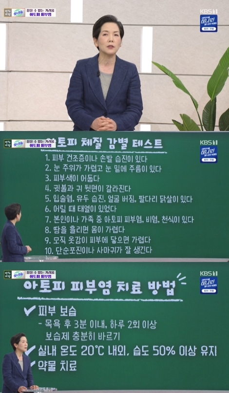 '아침마당' 방송 화면 갈무리 [사진=KBS]