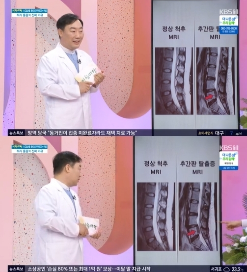 14일 방송된 KBS 1TV '아침마당'에서는 경희대학교 의과대학 재활의학과 김동환 교수가 출연해 100세 허리 만드는 올바른 척추 건강과 치료법을 공개했다. [사진=KBS]