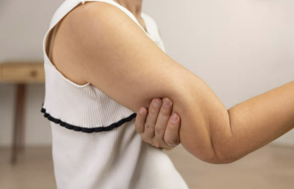 팔뚝 살 관련 이미지. 기사에서 언급된 제약사와 무관함. [사진=픽사베이]