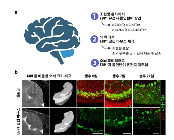 국내 연구팀이 조현병 환자에서 소뇌의 크기가 감소하는 현상의 새로운 원인 유전자로 ‘Ebp1’과 그 작동원리를 알아냈다 [사진=한국연구재단]