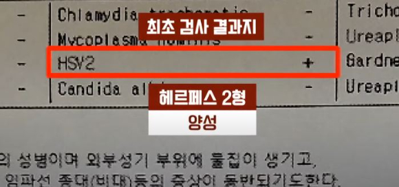 산부인과에서 '성병 오진'을 받아 남편과 이혼까지 생각했다는 결혼 20년차 이상 아내의 사연이 전해졌다. 사진은 여성 A씨가 서울 강서구 한 산부인과에서 받은 검사 결과. [사진=JTBC 사건반장 화면 캡처]