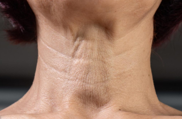 바세린을 목에 바르면 목주름을 없애는 데 효과가 있다는 전문의의 분석이 나왔다. 사진은 본 기사 내용과 무관함. [사진=House of Beauty Camberley]