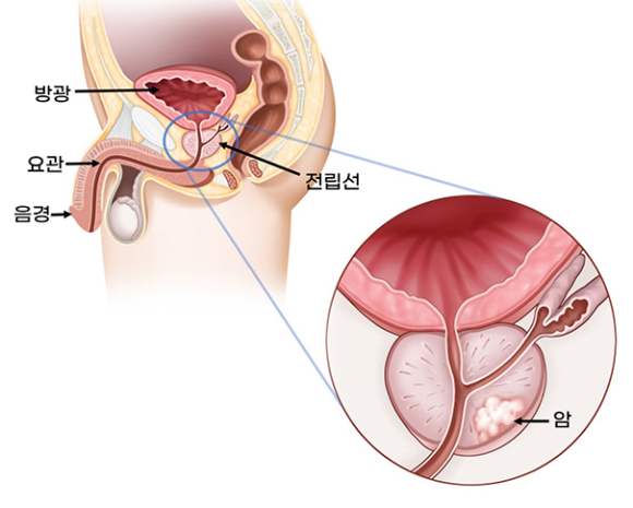 한 달 평균 20회 이상 사정한 남성은 전립선 암 발생 위험이 낮아진다는 연구 결과가 나왔다. 사진은 본 기사 내용과 무관. [사진=Toru Kimura]