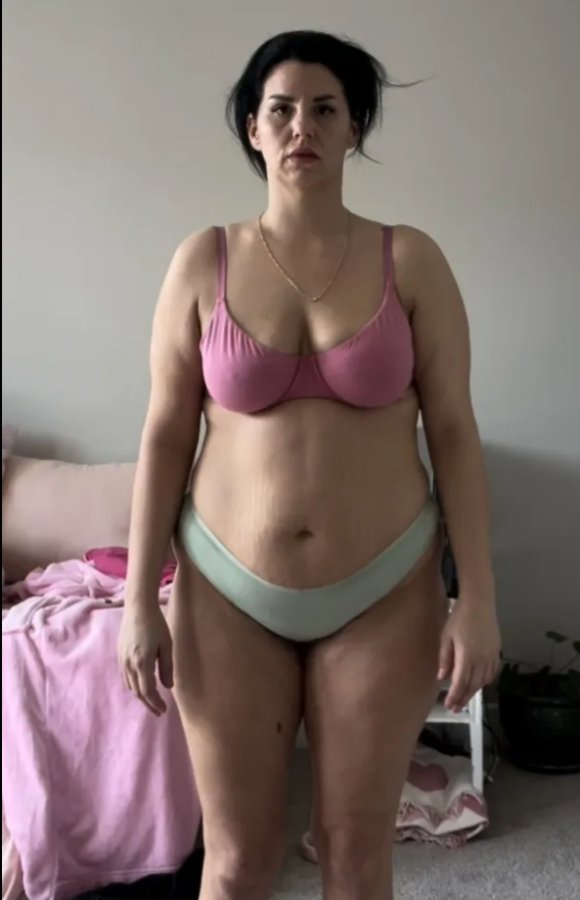 처진 살을 고민하던 30대 여성이 복부 성형, 가슴 리프팅, 지방흡입을 포함한 일명 '마미 메이크오버(mummy makeover)' 수술을 받았다가 심각한 부작용을 겪었다.사진은 수술 전 에리카 자코. [사진=더선]