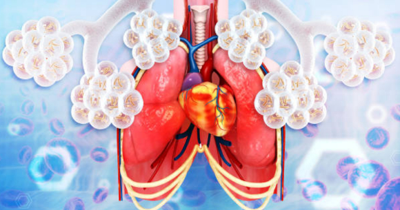 폐섬유증과 관련된 이미지. [사진=픽사베이]