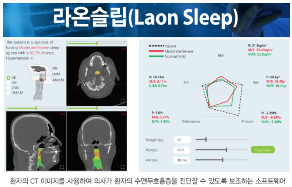라온피플은 최근 코엑스에서 열린 2022 국제의료기기&병원설비전시회(KIMES)에서 대한민국 11호 혁신의료기기로 지정된 AI융합 영상진단소프트웨어 '라온슬립(Laon Sleep)'을 공개하고 성능을 시연했다. [사진=라온피플]