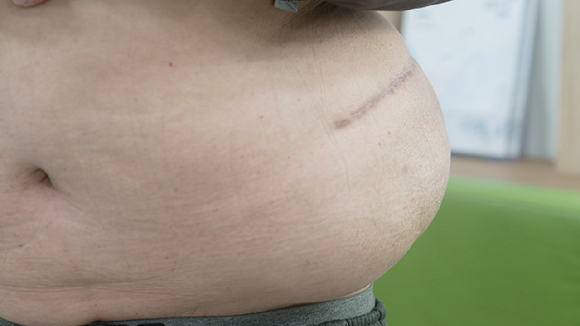 EBS '명의' 스틸컷. [사진=EBS]