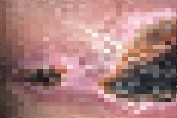 처진 살을 고민하던 30대 여성이 복부 성형, 가슴 리프팅, 지방흡입을 포함한 일명 '마미 메이크오버(mummy makeover)' 수술을 받았다가 심각한 부작용을 겪었다.사진은 수술 전 에리카 자코. [사진=더선]