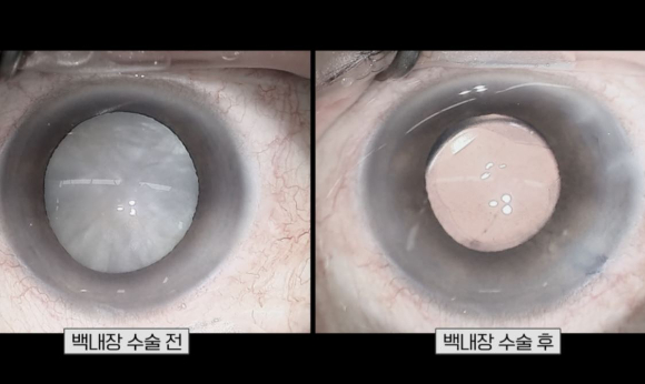 EBS '명의' 스틸컷. [사진=EBS]