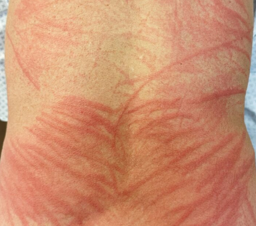 추운 겨울을 맞아 전골과 국물 요리에 빠지지 않는 버섯을 먹고 식중독이나 피부염을 호소할 수 있다는 전문가의 설명이 나왔다. [사진=마켓컬리]