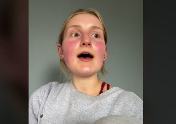 스코틀랜드의 한 여성이 많은 양의 당근을 먹다가 피부가 주황색으로 변하게 된 일화를 공개했다. [사진=데일리메일]