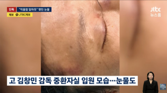 故 김창민 감독, 응급실 사진 공개됐다 '처참'...父 "의식 없는데 눈에 눈물...얼마나 억울하면"
