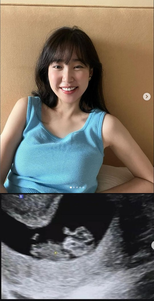 최희 [사진=최희 SNS]