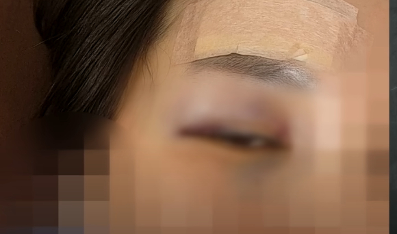 헬스장에서 운동을 하던 중 한 남성의 실수로 20㎏ 바벨이 머리 위로 떨어져 크게 다친 여성 사연이 전해졌다. 본 기사와 무관한 이미지. [사진=픽사베이@ trainmoment]