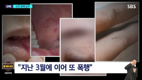 지난달 30일 서울시 양천구의ㅏ 한 초등학교에서 여교사가 다른 학생들이 보는 앞에서 6학년 남학생에게 무차별 폭행을 당한 사건이 벌어졌다. [사진=SBS 보도화면 캡처]