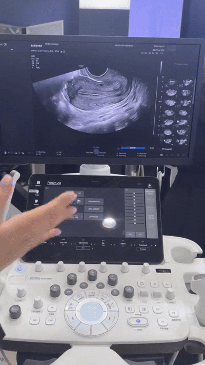 삼성전자 의료기기사업부와 삼성메디슨 부스. [사진=황세웅 기자]