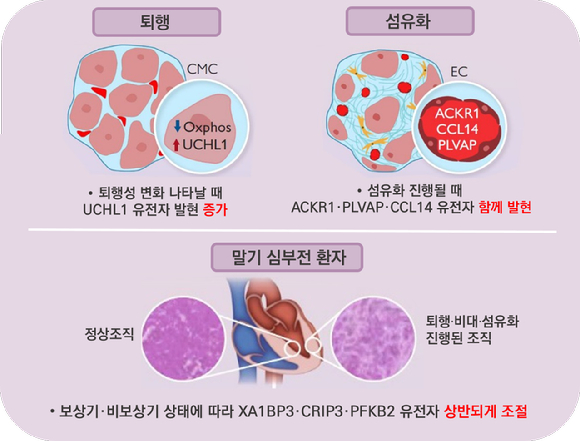 서울아산병원 연구팀이 심근병증 발병에 관여하는 유전자를 찾아냈다. [사진=서울아산병원]