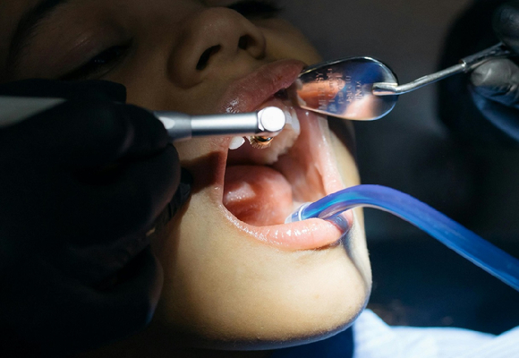 치과 치료 이미지. 기사와 직접 관련이 없는 사진 [사진=픽셀스]