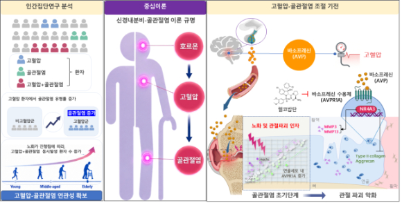 고혈압이 골관절염 악화시키는 분자 원리 규명...사이언스 게재
