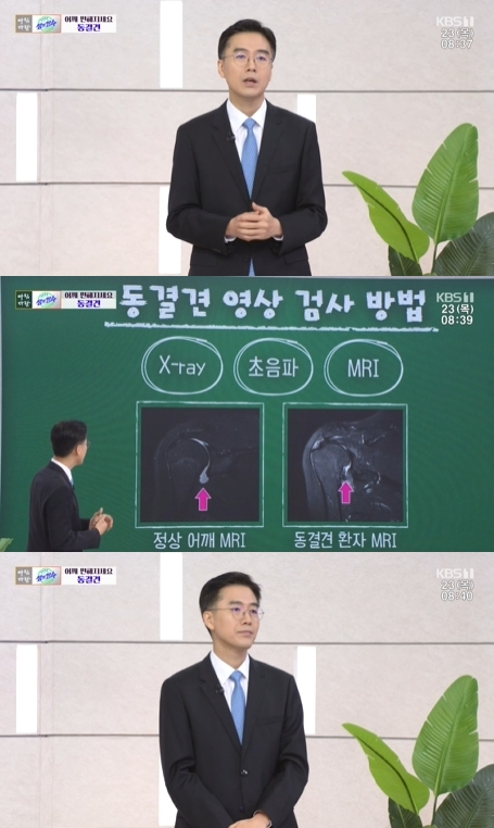 '아침마당' 방송 화면 갈무리 [사진=KBS]