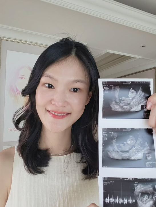 개그맨 김경진의 아내이자 모델 전수민이 쌍둥이 임신소식을 전했다. [사진=전수민 인스타그램 ]