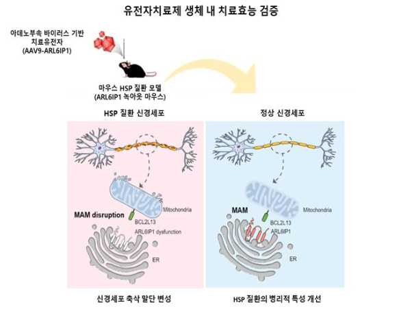 유전성 하지강직성 대마비 증후군의 원인 유전자인 ARL6IP1 유전자의 변이에 따른 병인 기전 규명 및 아데노부속 바이러스 기반 유전자 치료제 치료효능 검증 모식도.  ARL6IP1 유전자를 제거한 마우스 HSP 질환 모델을 통해 신경세포 내 ARL6IP1 변이에 따른 병인 기전을 규명하고, AAV 바이러스 기반 유전자치료제의 치료효능을 검증했다. [사진=한국생명공학연구원]