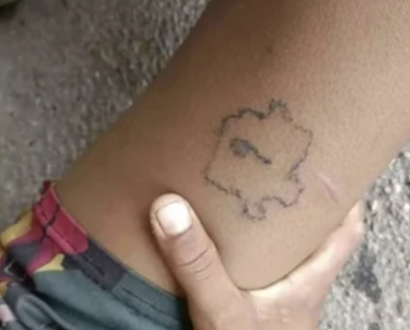 태국에서 10살 초등학생이 같은 반 친구들에게 강제로 외설적인 단어와 그림이 새겨진 '이마 타투'를 당하는 학교 폭력이 일어나 충격을 주고 있다. 사진은 피해 아동. [사진=X 갈무리 ]