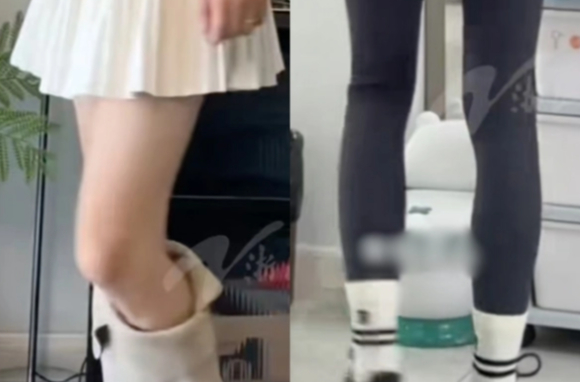 중국의 한 30대 남성이 여성 모델 못지않은 늘씬한 각선미로 패션 브랜드들의 러브콜을 받으며 화제다. 사진은 쉬 씨의 다리. [사진=틱톡]