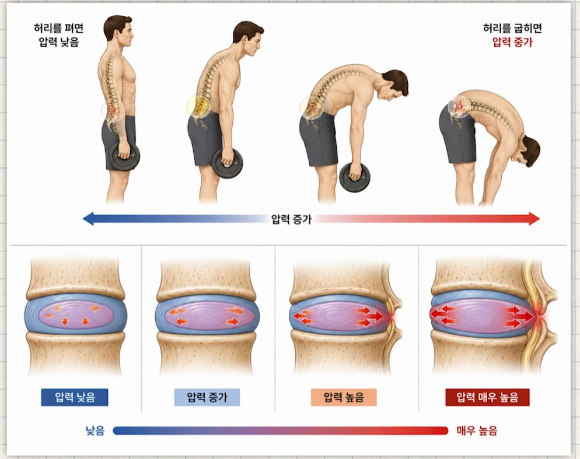 병원이 아닌 집에서도 허리 통증을 완화시킬 수 있는 운동들이 전문의에 의해 소개됐다. 본 기사와 무관한, AI 생성 이미지. [사진=제미나이 생성 이미지]