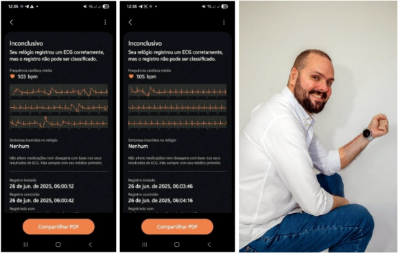 브라질 남성 &quot;갤럭시 워치 덕분에 살았다&quot; 밝혀 화제