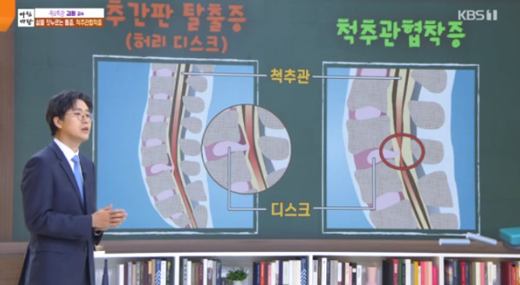 김원 서울아산병원 재활의학과 교수가 '아침마당'에서 강연을 하고 있다.[사진=KBS 방송화면 캡처]