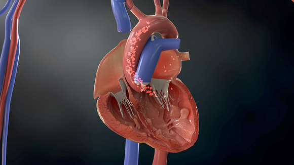 가슴을 짓누르는 흉통과 함께 조금만 움직여도 숨이 차다면 심장 기능이 떨어지는 심근병증일 수 있다. [사진=EBS]