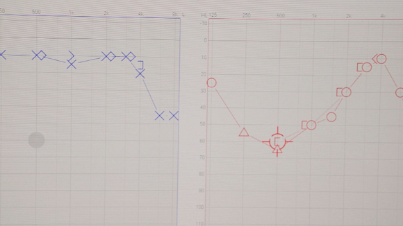 EBS '명의' 스틸컷. [사진=EBS]