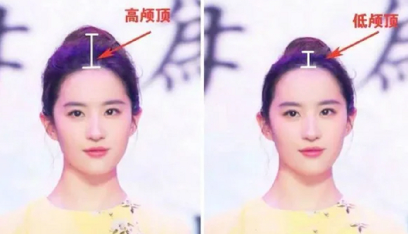 사진은 정수리 볼륨에 따른 얼굴형을 비교한 모습. [사진=페이스북 갈무리 ]