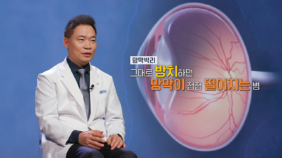 오는 23일 오후 9시 55분에 방송되는 EBS '명의' '실명할 수 있습니다 - 망막박리' 편에서는 실명의 위험에 처한 환자들의 치료에 매진하는 안과 이성진 교수와 망막박리의 원인과 치료법, 그리고 예방법을 알아보는 시간을 가진다. [사진=EBS]