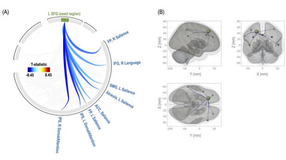 가설 기반(Hypothesis-driven) 신경학적 연결망 지도. 연구팀은 통계적 학습에 관여하는 상전두회(superior frontal gyrus, SFG)가 하향 조절과 관련된 다른 뇌 영역들과 깊은 관련이 있다는 것을 새로 제시했다. 또한 해당 연결망은 음의 방향으로 강해질수록 통계적 학습을 더 잘하는 것으로 밝혀졌다. [사진=DGIST]