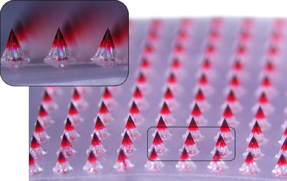 대웅테라퓨틱스가 개발한 마이크로니들 패치의 약물층을 시각적으로 표현하기 위해 색소를 첨가하고 6.7배 확대 촬영한 모습. [사진=대웅 제공]