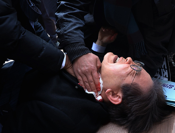 2024년 1월 2일 당시 더불어민주당 이재명 대표가 부산 가덕도 신공항 부지를 둘러본 후 기자들과 문답을 진행하던 중 왼쪽 목 부위에 습격을 당해 피를 흘린 채 쓰러졌다. [사진=연합뉴스]