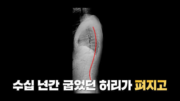 오는 22일 오후 9시 55분에 방송되는 EBS '귀하신 몸' '부모님과 함께 봐야 할, 허리 낫는 법' 편에서는 척추를 망치는 최악의 자세와 잘못된 운동을 모조리 바로잡고, 허리 통증에서 벗어날 초간단 스트레칭부터 운동법까지 전부 공개할 예정이다. [사진=EBS]