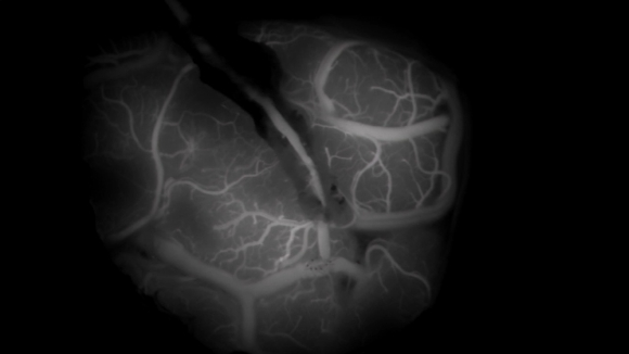 EBS '명의' 스틸컷. [사진=EBS]