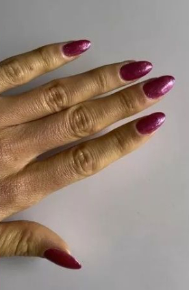 스코틀랜드의 한 여성이 많은 양의 당근을 먹다가 피부가 주황색으로 변하게 된 일화를 공개했다. [사진=데일리메일]